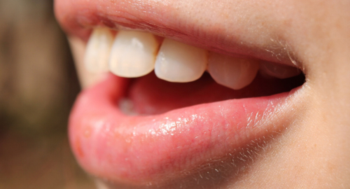 Aloe vera e salute orale: cosa dice la scienza?
